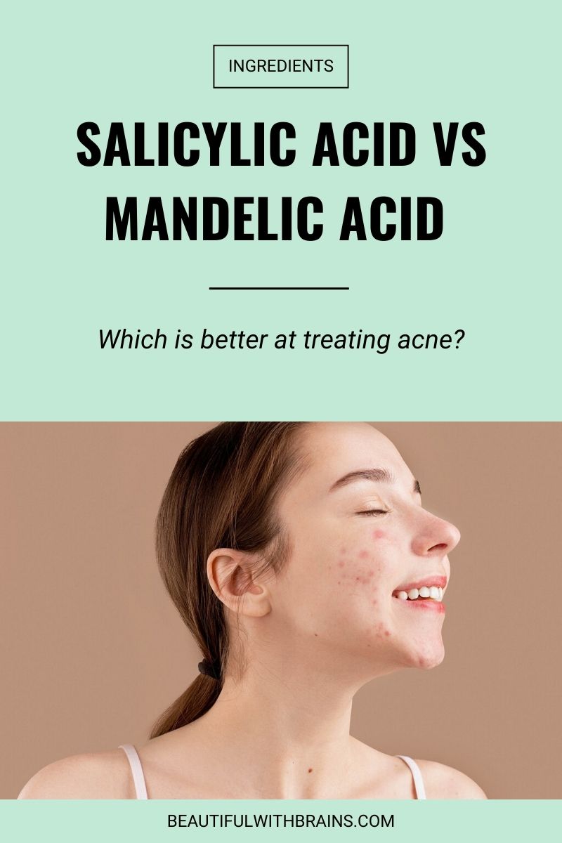 salicylic acid vs mandelic acid for acne