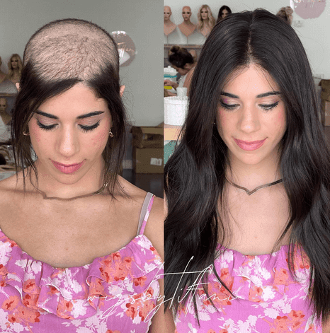 Best Wigs For Hair Loss, Barbies Beauty Bits