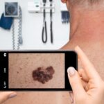 Piction Health App Skin Conditions