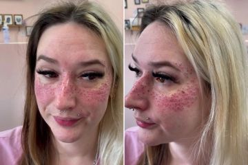 Tattooist shows off freckles she gave to a client… but people are horrified